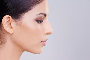 Cartilage Rhinoplasty image